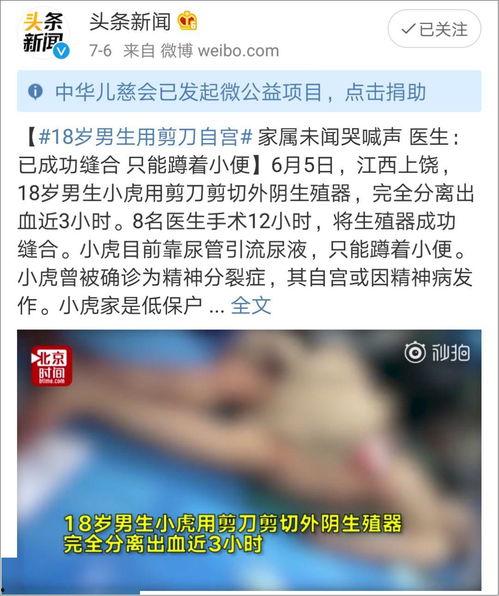网红烫烟头爆料视频下载,揭秘烟头背后的惊人真相  第1张